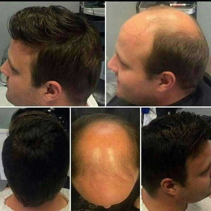 Client Transformations